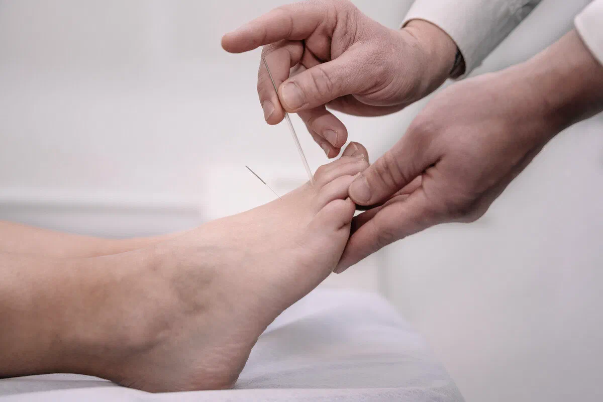 Ayakta his muayenesi (monofilament testi)